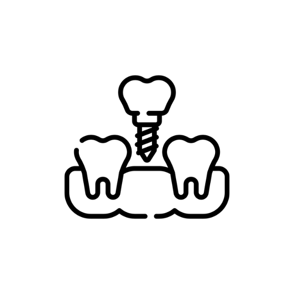زراعة الأسنان