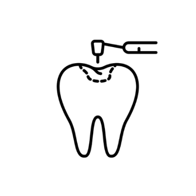 حشو الأسنان