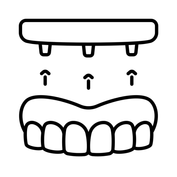 تركيبات متحركة