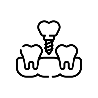 زراعة الأسنان