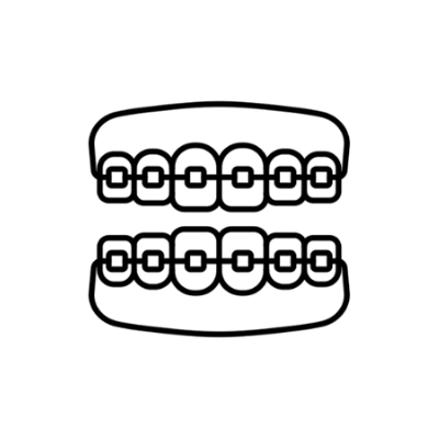 تقويم الأسنان